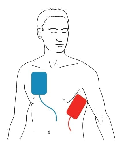 Unresponsive and abnormal breathing when a defibrillator is available